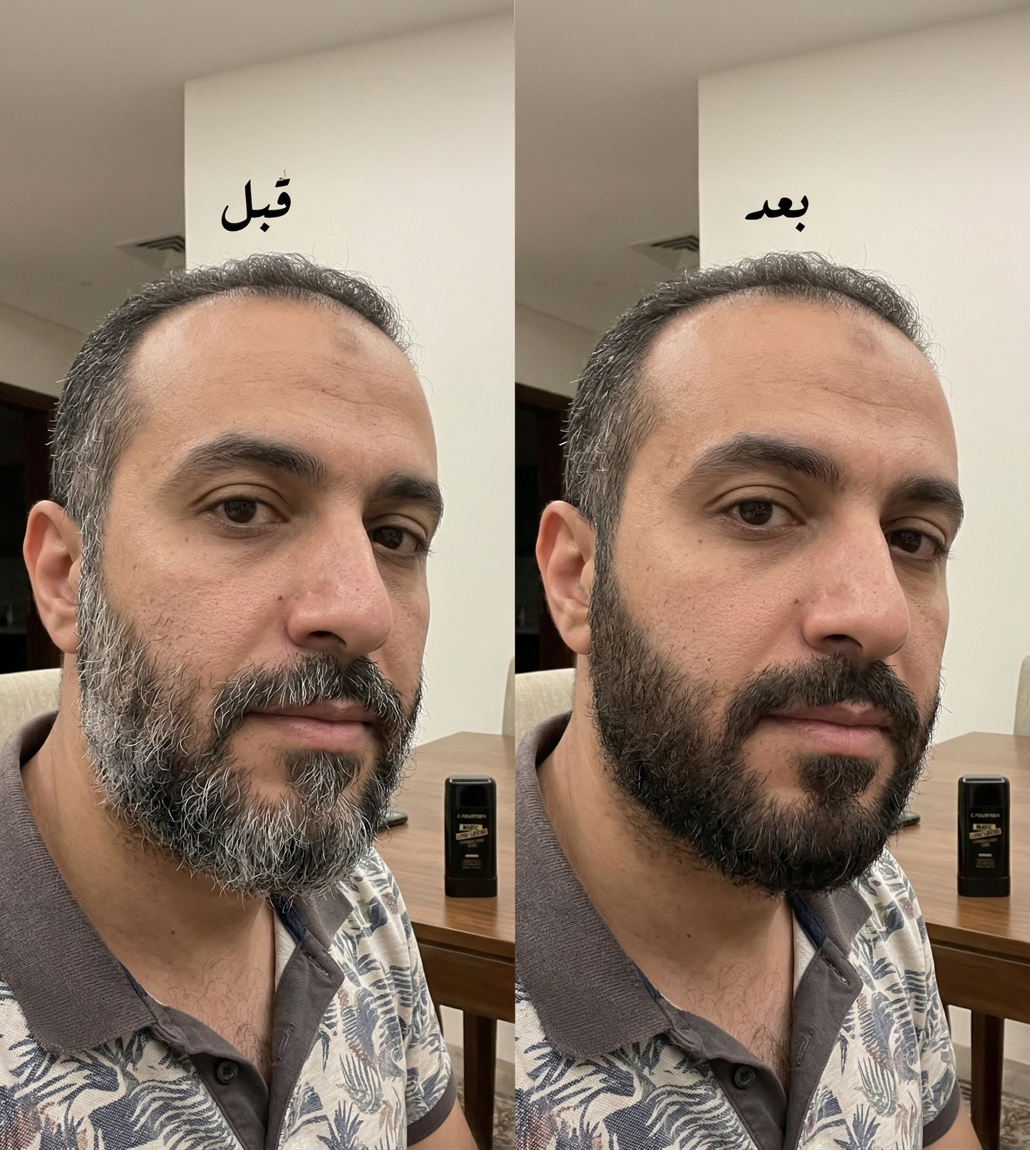القلم السحري لإزالة الشيب في ثواني