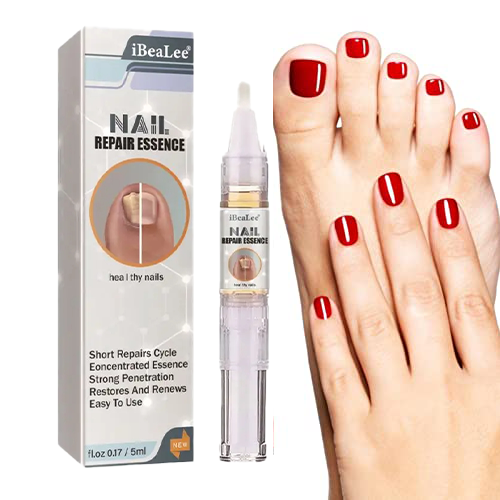 العلاج النهائي لمشاكل فطريات الأظافر